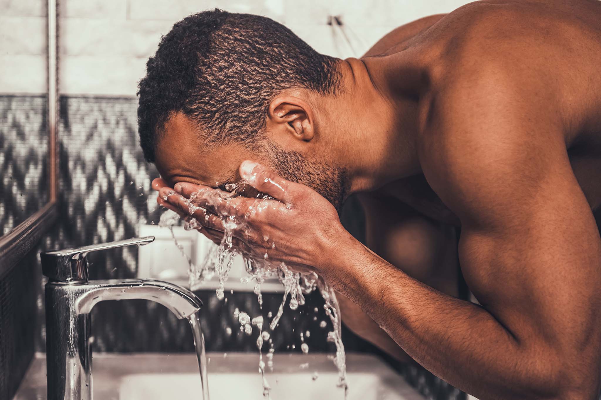 The PRX Skin Treatment: 5 Things You Should Know