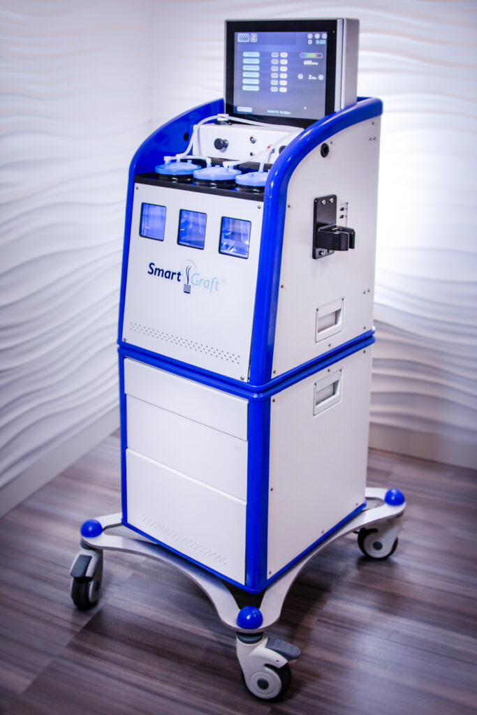 Smart Graft Machine for hair restoration at AW Plastic Surgery