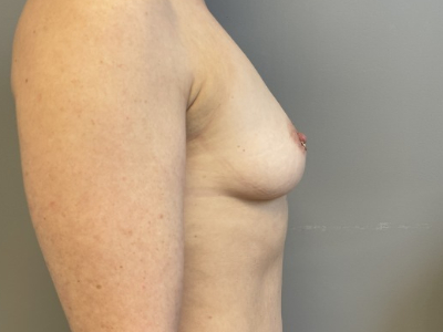 before_image
