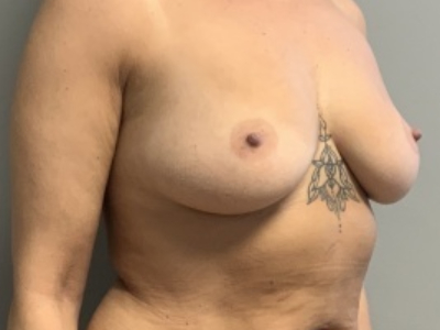 before_image