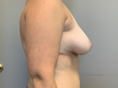 before_image