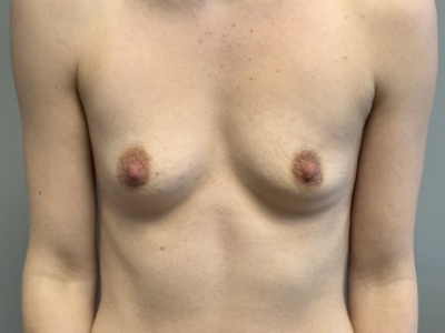 before_image