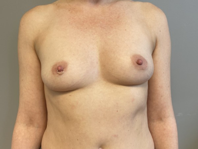 before_image