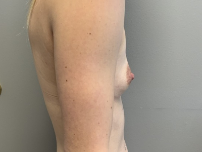 before_image