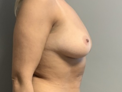 before_image