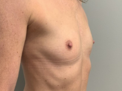 before_image