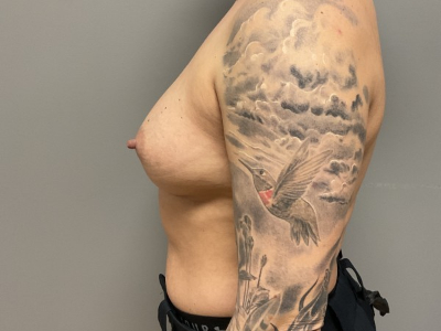 before_image