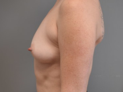 before_image
