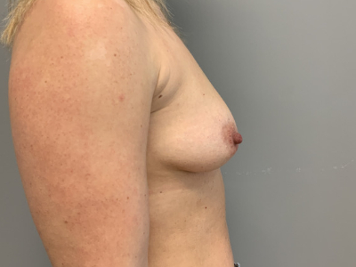 before_image