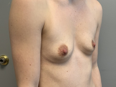 before_image
